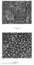Fig. 02 - Method of deriving mature hepatocytes from human embryonic stem cells