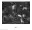Fig. 03 - Method of deriving mature hepatocytes from human embryonic stem cells