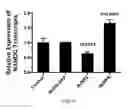 Fig. 22 - Pharmaceutical composition comprising Nanog shRNA, and method of using Nanog shRNA to treat cancer
