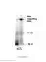 Fig. 06 - Selection of RNA-aptamers as anti-malaria agents