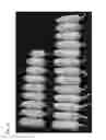 Fig. 11 - Nucleic acid imparting high-yielding property to plant, method for producing transgenic plant with increased yield, and method for increasing plant yield