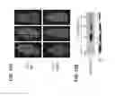 Fig. 12 - Controlling fungal pathogens by disabling their small RNA pathways using RNAi-based strategy