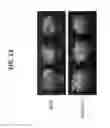 Fig. 15 - Controlling fungal pathogens by disabling their small RNA pathways using RNAi-based strategy