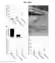 Fig. 05 - Soybean resistant to cyst nematodes