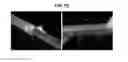 Fig. 11 - Soybean resistant to cyst nematodes