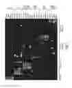 Fig. 04 - COMPOSITIONS AND METHODS FOR REPROGRAMMING HEMATOPOIETIC STEM CELL LINEAGES