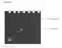 Fig. 04 - Recombinant microorganisms for enhanced production of mevalonate, isoprene, and isoprenoids