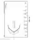 Fig. 16 - Detection and classification of an anticoagulant using a clotting assay