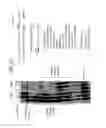 Fig. 28 - Recombinase Polymerase Amplification