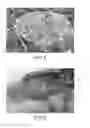 Fig. 04 - Method for reversing recent-onset type 1 diabetes (T1D) by administering substance P (sP)