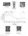 Fig. 03 - Diagnostic Method Using PALB2/US