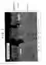 Fig. 03 - METHOD FOR MANUFACTURING GALVANIZED STEEL SHEET FOR HOT STAMPING, HOT-DIP GALVANNEALED STEEL SHEET FOR HOT STAMPING AND METHOD FOR MANUFACTURING SAME, AND HOT STAMPED COMPONENT