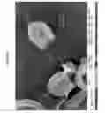 Fig. 15 - Porous particles and methods of making thereof