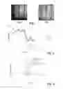 Fig. 04 - Silicon block, method for producing the same, crucible of transparent or opaque fused silica suited for performing the method, and method for the production thereof