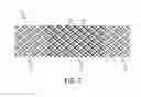 Fig. 06 - Variable porosity intravascular implant and manufacturing method