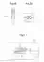Fig. 03 - Stitch line forming method