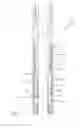 Fig. 05 - DOWNHOLE VIBRATION TOOL