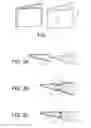 Fig. 02 - SHOT PEENING DEFORMATION PROCESS FOR ASSEMBLING TWO PARTS OF A TURBOMACHINE