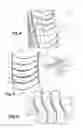 Fig. 03 - Application of a connection joint to a stator stage by means of inflatable bladders