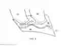 Fig. 04 - Gas turbine engine end-wall component