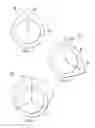 Fig. 04 - Six Stroke Internal-Combustion Engine