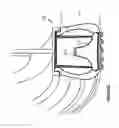 Fig. 10 - Contact Interface Energy Harvesting Systems and Methods