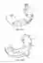 Fig. 35 - Fan assembly