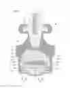 Fig. 02 - Vibrationproof device