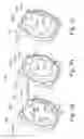 Fig. 10 - Absorber-Type Vibration Damper