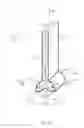 Fig. 10 - Light guide illumination device for direct-indirect illumination