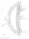 Fig. 04 - ELECTRIC LIGHT FIXTURE
