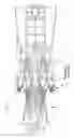 Fig. 02 - SEAL IN COMBUSTOR NOZZLE OF GAS TURBINE ENGINE