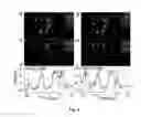 Fig. 04 - Spatiotemporally resolved far-field pulse contrast measuring method and device