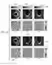 Fig. 24 - System and method using OAM spectroscopy leveraging fractional orbital angular momentum as signature to detect materials