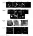 Fig. 05 - Systems and methods for detection of cellular stress