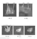 Fig. 04 - Biological specimen evaluation methods using cytology and immunology
