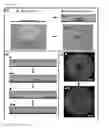 Fig. 07 - MULTIPHASE MICROARRAYS AND USES THEREOF