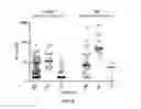 Fig. 13 - Use of ACY-1 as a marker of ischaemia/reperfusion, delayed graft function and graft viability as well as method thereof