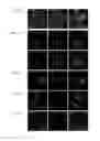 Fig. 14 - USE OF POLYCLONAL AND MONOCLONAL ANTIBODIES SPECIFIC FOR 3-PHOSPHOHISTIDINE