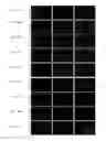 Fig. 16 - USE OF POLYCLONAL AND MONOCLONAL ANTIBODIES SPECIFIC FOR 3-PHOSPHOHISTIDINE
