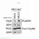 Fig. 04 - Biomarker PNCK for predicting effect of a dual-targeting agent