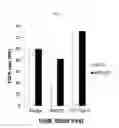 Fig. 05 - Biomarker PNCK for predicting effect of a dual-targeting agent