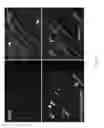 Fig. 06 - Methods for the diagnosis of amyotrophic lateral sclerosis