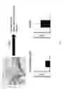 Fig. 08 - Methods for the diagnosis of amyotrophic lateral sclerosis