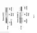 Fig. 09 - Methods for the diagnosis of amyotrophic lateral sclerosis