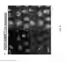 Fig. 10 - Methods for the diagnosis of amyotrophic lateral sclerosis