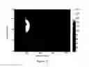 Fig. 12 - Enhancement of magnetic resonance image resolution by using bio-compatible, passive resonator hardware