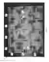 Fig. 05 - Detector grid arrays for MR imaging