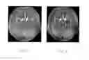 Fig. 05 - Magnetic resonance angiography method and apparatus
