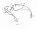 Fig. 04 - EYEGLASSES FOR BLOCKING ALLERGENS